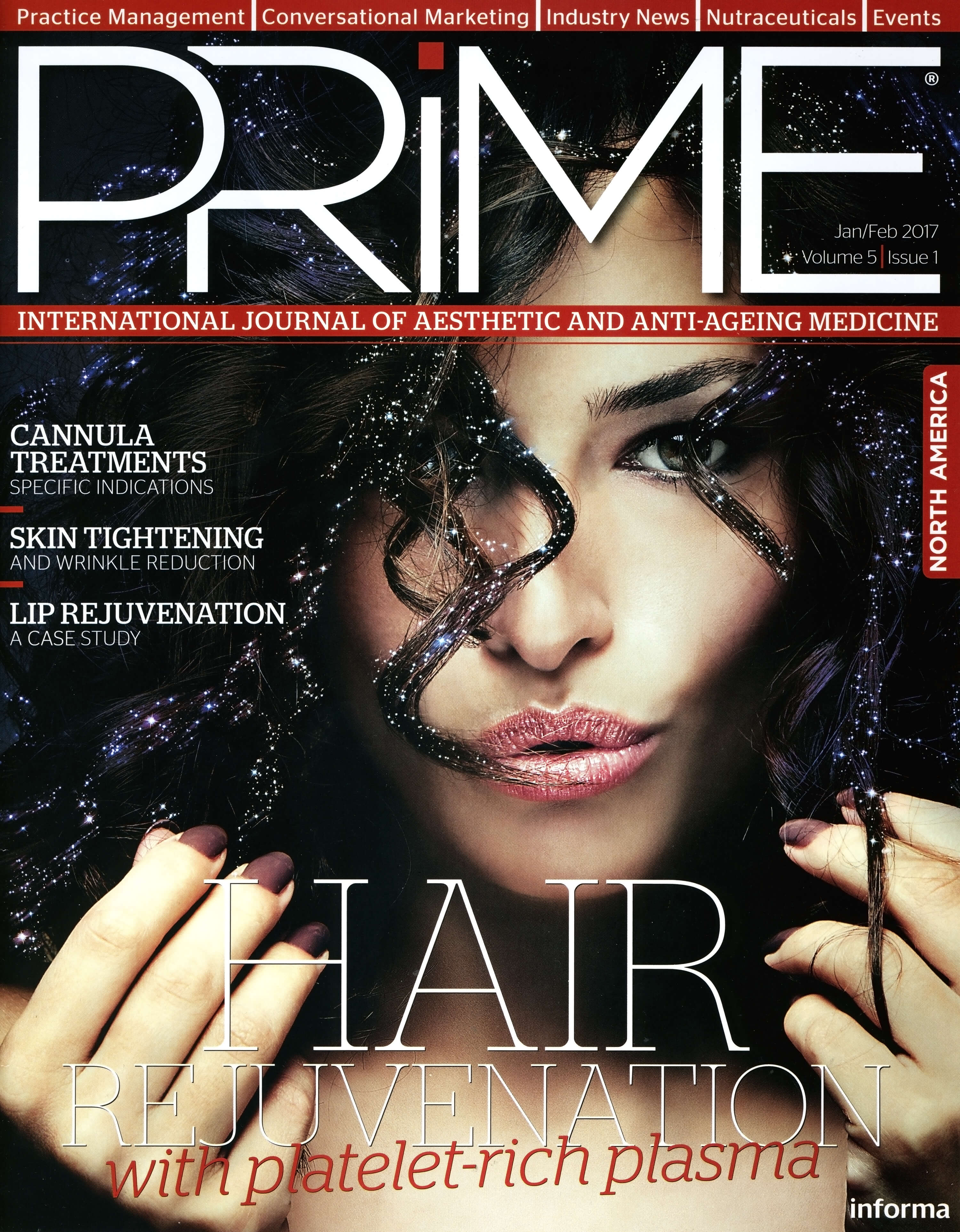 PRIME_JAN17